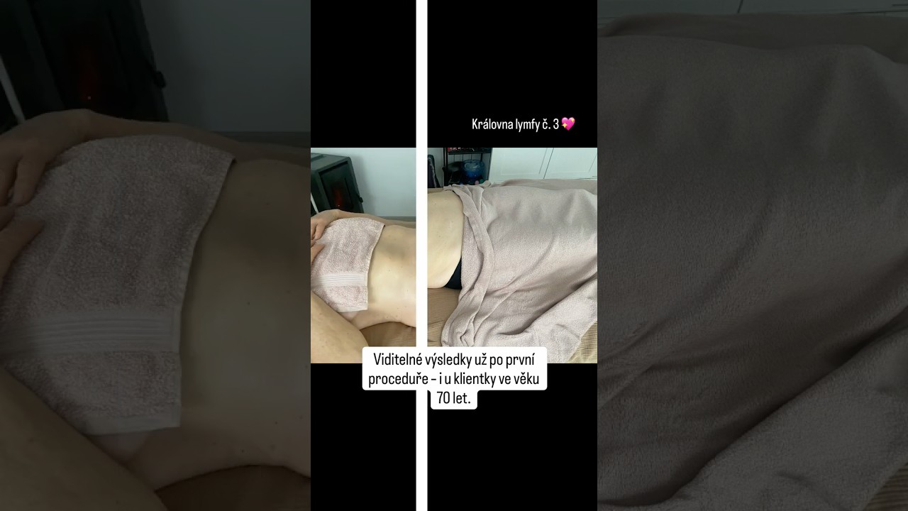 Lymfomodeling